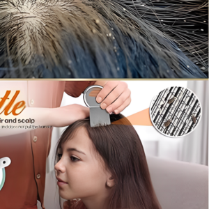 Steel Lice Removal Comb
